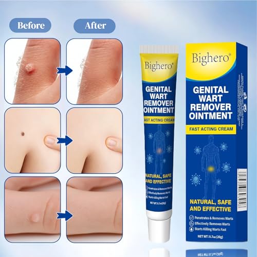 Image of Bighero 2 Pack Wart Fast Acting Gel Wart Remover Freeze Off Ointment,Wartes Cream for Genital Wartss, Warts, Plantar Warts, Common Wartes, Corn, Flat Wars NDC (84010-047-02)
