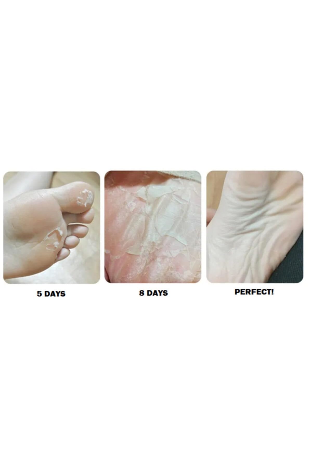Rituel De Beaute Purederm Ayak Ölü Deri Soyucu Peeling Ayak Maskesi (46 Ayak Numarasına Kadar Uyumlu), Dnz80880