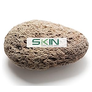 Skinapeel Grote puimsteen – natuurlijke voetverzorgingsscruber – dode harde huid eeltverwijderaar – Pedicure Tool…