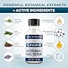 FUNGINIX Fungus Treatment - Toe Fungus, Finger Fungus, and Foot Fungus Solution Made In the USA - Extra Strength (1 Bottle)