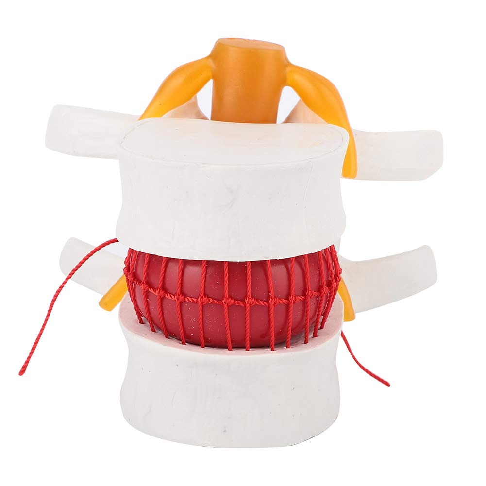 Modèle Vertebre, Vertebres Anatomie, Modèle de vertèbres lombaires colonne vertébrale anatomique, modèle de démonstration médicale 1: 1,5 du discale Humaine de la Colonne vertébrale Lombaire