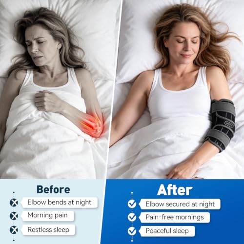 Elbow Brace for Cubital Tunnel & Ulnar Nerve