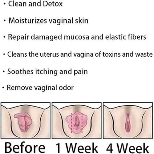 Miniatura 7 de Anniecare - Cápsulas vagianales de reparación natural, productos para adelgazar desintoxicación instantánea antipicazón, reparación de