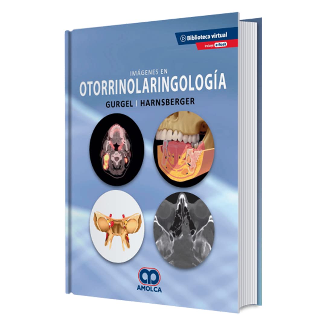 GURGEL IMAGENES EN OTORRINOLARINGOLOGIA