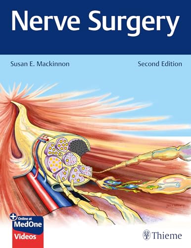 Nerve Surgery