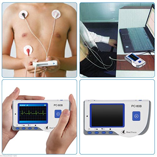 MascarelloHEAL FORCE PC80B Handheld Color ECG EKG Portable Heart