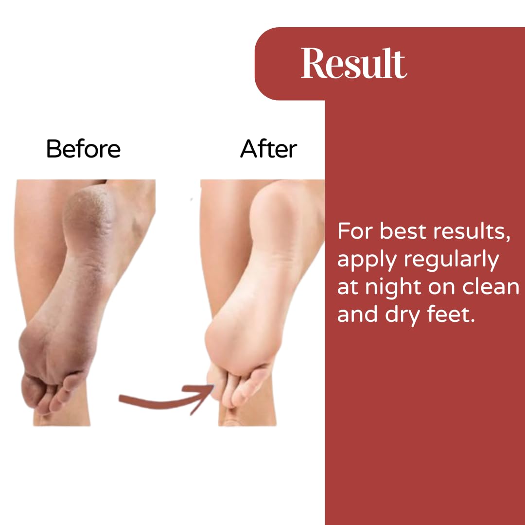 Trycone Foot cream for Cracked Heels with Rose Oil and Kokum Butter- Pack of 2 4