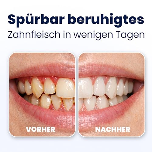 Royal Denta Zahnpasta ohne Fluorid 2x130 g, Hydroxylapatit-Zahnpasta mit Xylit für empfindliches… – Ansicht 4