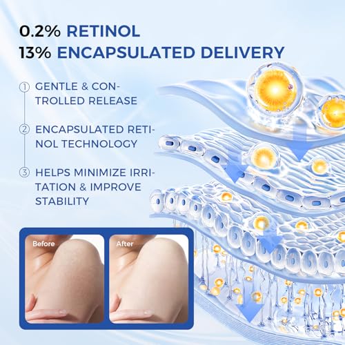 Image of OUKEYA Retinol Body Lotion with Aloe Vera & Vitamin E, Firming, 16.9 Fl Oz | Skin Smoothing & Toning, Night Renewal Care, Brightening, Smooths Crepey Texture And Hydrates, Non-Greasy,All Skin Types