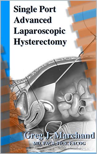 Single Port Advanced Laparoscopic Hysterectomy: An Advanced Ultra-Minimally Invasive Surgical Technique