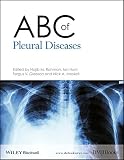 ABC of Pleural Diseases (ABC Series Book 158) (English Edition)