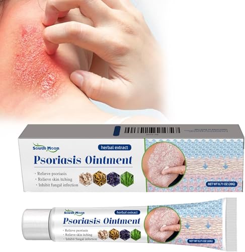 Crema Antifúngica 20g, Tratamiento Eficaz Contra la Tiña, el eccema, Pie De Atleta, Alivia la Picazón, Antifúngico, Descamación, Alivia Rápidamente los Irritación Y Enrojecimiento en el Cuerpo Y la Ca