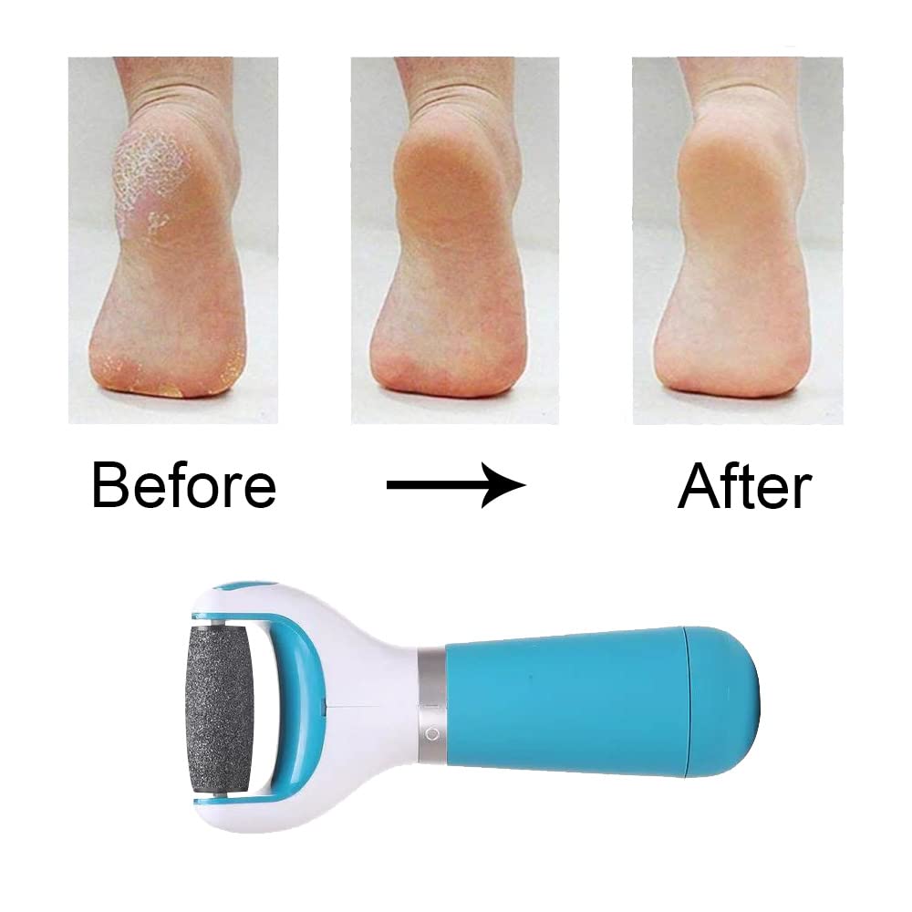 Electric Foot File Professional Hard Skin Remover Foot Care Skin Remover for Removing Cracked Heels and Dead Skin Within Minutes(Blister Package) - Image 4