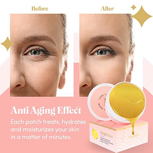 Linduray Skincare 24K Gold Collagen Under Eye Mask - Bright Eyes Anti Aging Treatment #TOP4