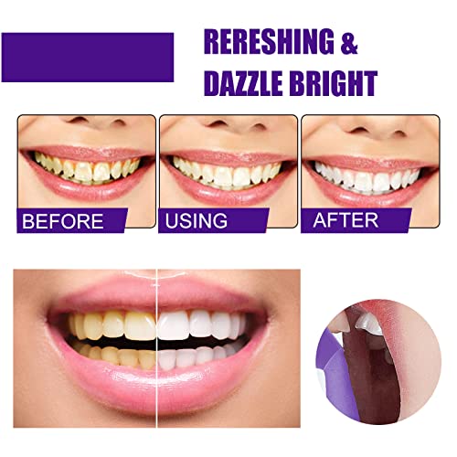 Purple Toothpaste For Teeth Whitening, Teeth Whitener, V-34 Color Corrector Toothpaste, Purple Teeth Whitening Toothpaste, Teeth Whitening Mousse, Foam Toothpaste Whitening Stain Removal #TOP1