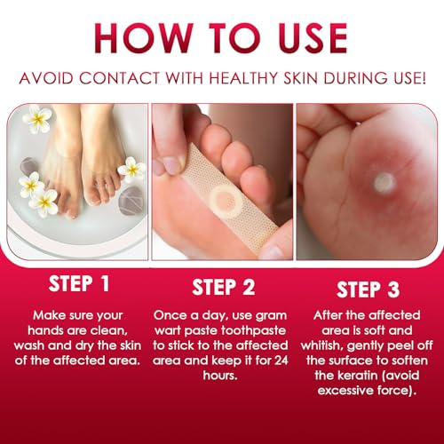 42 Cerotti Per Verruche Mani E Piedi, Cerotti Rimozione Calli E Duroni, Cerotti Con Foro Per Protezione Zona Interessata, Supporto Per Cura Dei Piedi E Delle Mani - 5