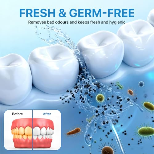 Image of Ultrasonic Retainer Cleaner with UV-C, 45kHz Rechargeable Dental Cleaning Machine 4000mAh, 200ML for Denture, Mouth Guard, Night Guard, Aligner, 3 Modes & 6 Cleaning Tablets