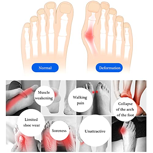 Image of SooGree 2 Pairs Honeycomb Fabric Forefoot Pads Men Women Soft Metatarsal Foot Pads Soft Gel Ball of Foot Cushions for Pain Relief