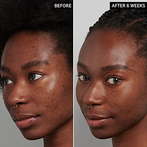 Thumbnail image for The INKEY List Tranexamic Acid Serum