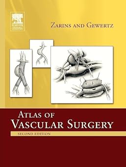 ATLAS OF VASCULAR SURGERY 2ED (PB 2009)