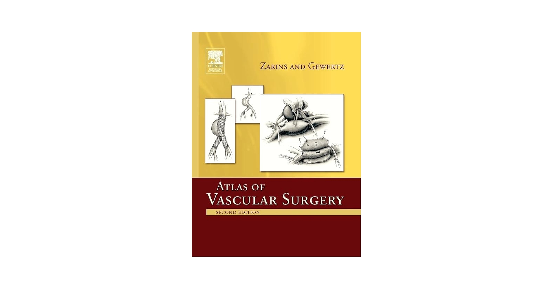 Atlas of Vascular Surgery - Paperback Edition: 9781437722253