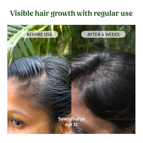 Image of Vilvah Hair Regrowth Oil | Reduces Hair Fall & Boosts Regrowth | With Pumpkin Seed, Kalonji, Castor Oil & Vitamin E | Strengthens Roots & Improves Scalp Health | Unisex | 100ml