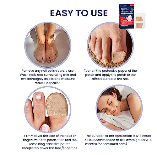 image for Scosvvi Toenail Fungus Treatment Extra Strength: Toe Nail Fungus Treat