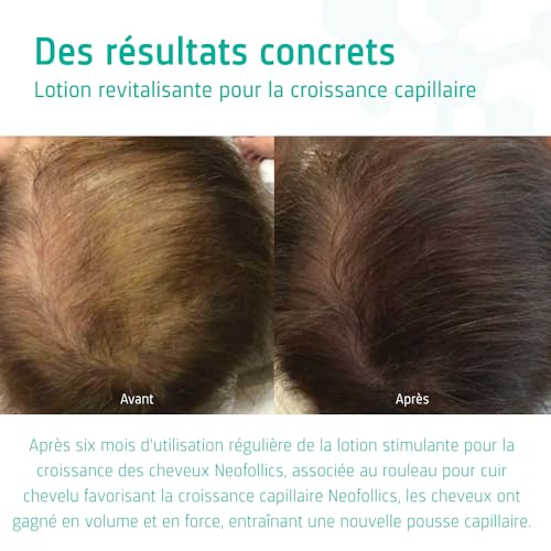 Chute de cheveux ? Stimulez la pousse avec Neofollics Lotion 7% Neoxyl 90ml