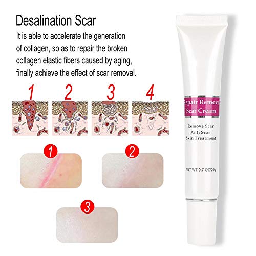 Crema per la rimozione delle cicatrici