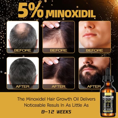 5% Minoxidil Hair Growth Serum Oil For Men and Women, Biotin Hair Serum, Safest Hair Regrowth Treatment, Prevent Scalp Hair Loss 60ml / 2.11 fl.oz - Image 3