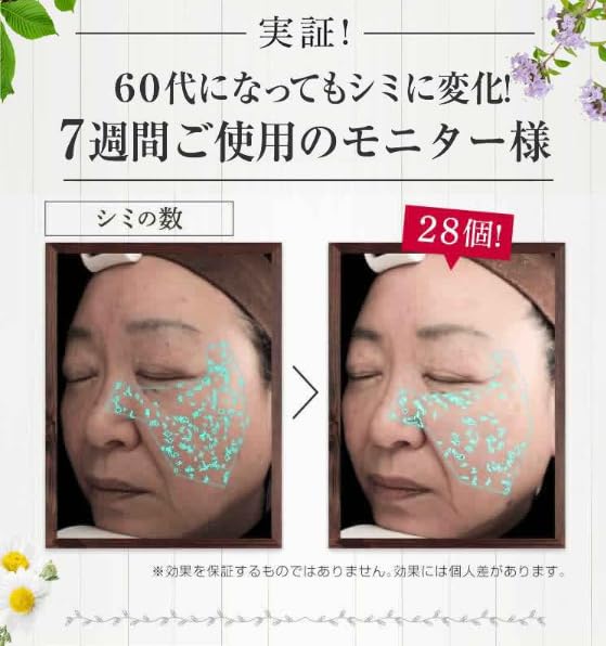 Amazon.co.jp: 医薬部外品 1et1/アンエアン [オールインワン美容液