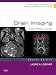 Brain Imaging: Case Review Series