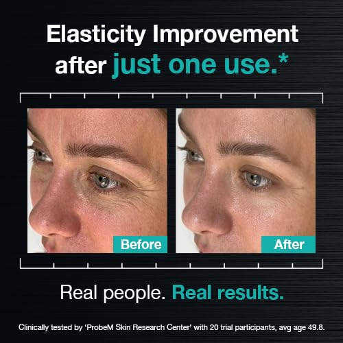 Advanced Wrinkle Repair Peptide Serum, Firming & Fine Line Smoothing, Fragrance-Free, 30 mL (Powered by PDRN 5% + Exosomes + Matrixyl® 3000 Peptides)