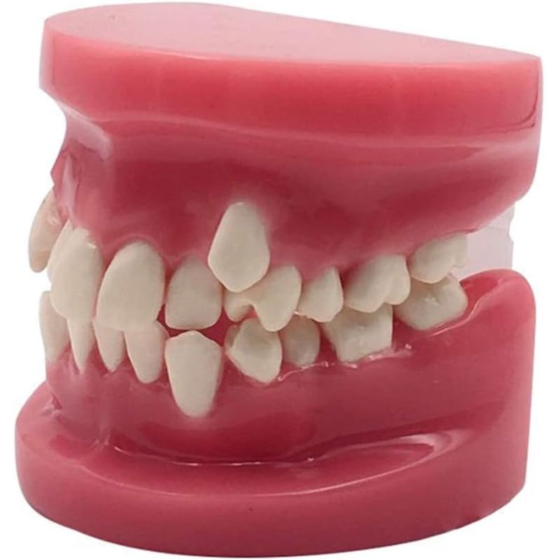 「NexPon」歯列矯正歯モデル-シミュレーション口腔歯タイポドン歯モデル-歯のケア教育研究デモンストレーションモデル-ラボ教育研究