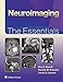 Neuroimaging: The Essentials (Essentials series)