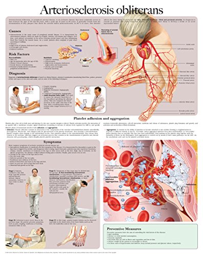 arteriosclerosis-obliterans-e-chart-full-illustrated-ebook-hc