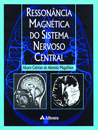 Ressonância Magnética do Sistema Nervoso Central (eBook)