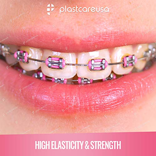 Plastcare Usa LIG-1040-1 2080 Ligature Ties For Braces - Multicolor Dental Orthodontic Ligature Ties thumb #4