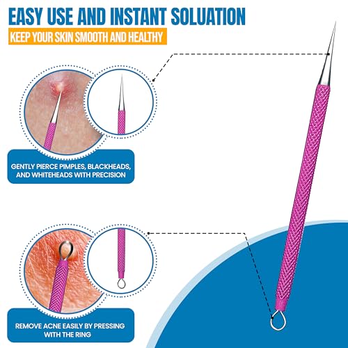 EFAH Care 2Pcs Stainless Steel Pimple Extractor Acne Treatment Tool Surgical Blemish Grade Blackhead Remover Perfect for face and Nose Easy to Clean (Pink)