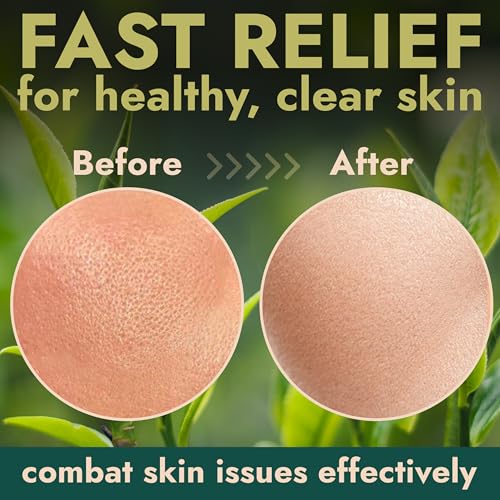 Terramed Just Think Comfort Pore Cleansing Mask - Blackhead Remover Clay Mask - Pore Minimizer for Face with Volcanic Ash & AHA - Itching, Burning, Redness Relief - Detoxifies and Refines Skin - Image 6