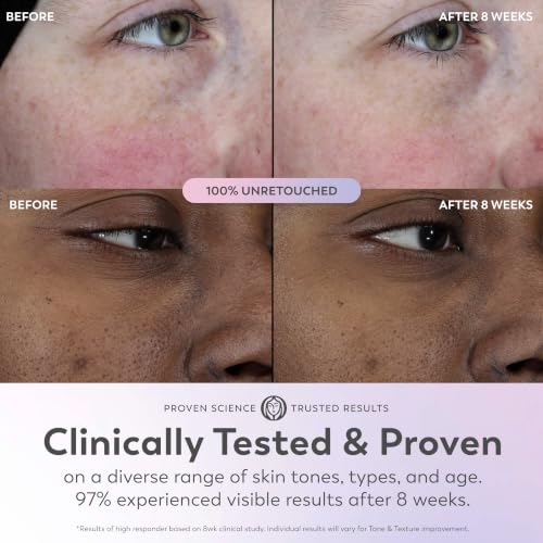 Image of Olay Super Serum - Glow Serum for Face - Activated Niacinamide, Vitamin C & E, Collagen Peptide, AHA - 5-in-1 Benefits - Brightens, Hydrates, Smooths, Firms, Evens Tone, Proactive Anti-Aging, 1.7 Oz
