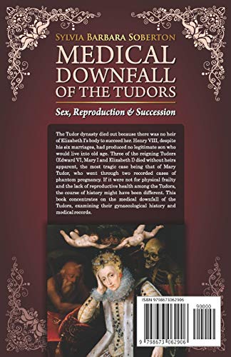 Medical Downfall Of The Tudors: Sex, Reproduction & Succession #TOP1