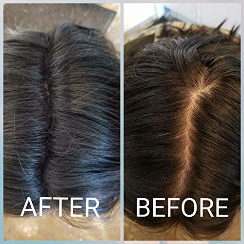 Image of SKINPLUS Hair Building Fibers, Keratin-Derived Fibres For Naturally Thicker Looking Hair, Thick Fiber (Black)