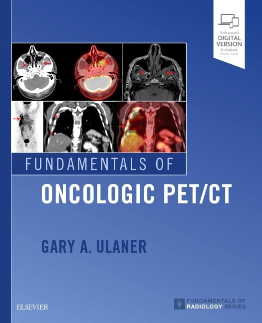 Fundamentals of Oncologic PET/CT (Fundamentals of Radiology ...