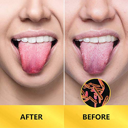 image for YIBIDINAY Tongue Scraper Cleaner for Adults Surgical Grade Stainless S