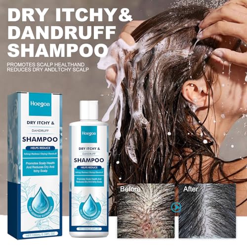Dry Scalp Shampoo Folliculitis Shampoo, Seborrheic Dermatitis Shampoo, Anti Dandruff Shampoo, Folliculitis Treatment, Dandruff Treatment, with Herbal Essence to Hydrate Hair, Relieve From Itchy - Image 7