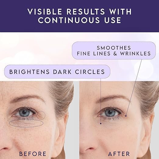 Retinol Eye Stick & Caffeine Under Eye Brightener – Under Eye Balm Stick for Dark Circles, Puffiness, Eye Bags, Wrinkles & Fine Lines, Cooling Under Eye Stick, 2 Pack - Image 4