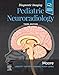 Diagnostic Imaging: Pediatric Neuroradiology