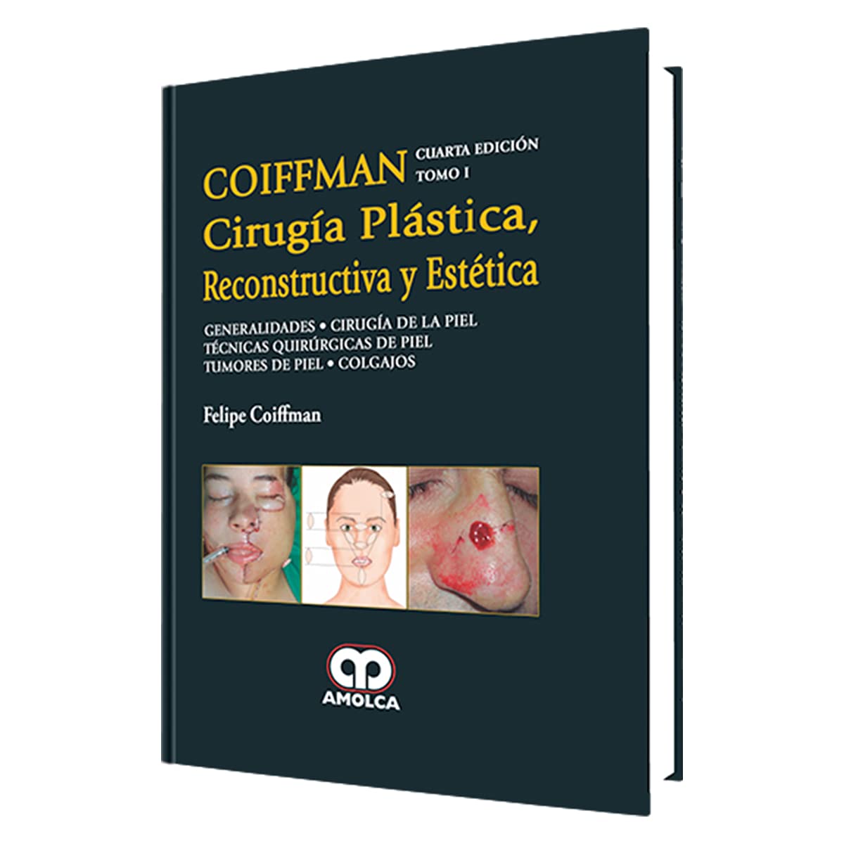 COIFFMAN CIRUGIA PLASTICA RECONSTRUCTIVA Y ESTETICA TOMO