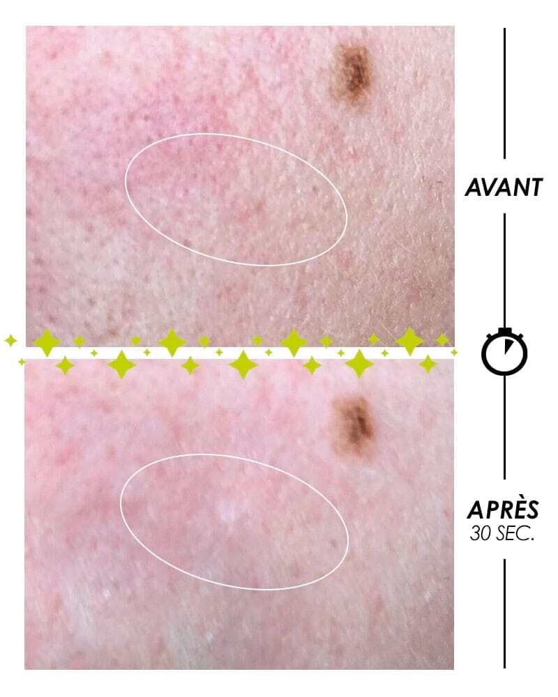 Garancia - [ PSCHITT MAGIQUE Nouvelle Peau ] VISAGE-Micropeeling sans grain ni acide de fruit, à action biologique 100ml